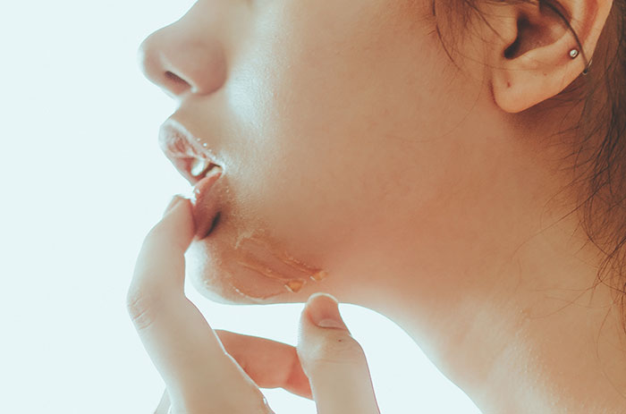 La digue dentaire protège des maladies lors du sexe oral